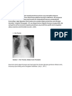 Diagnosis Aneurisma Aorta.docx