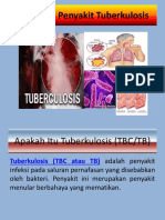 Tuberkulosis