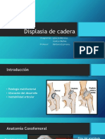 Displasia de Cadera