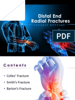 Colles Fracture