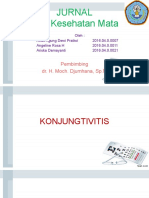 Konjungtivitis