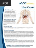 What Is Liver Cancer?