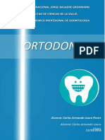 Retenedor Tipo Flecha en Ortodoncia