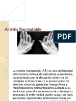 Artritis Reumatoid