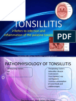 Tonsillitis: Refers To Infection and Inflammation of The Palatine Tonsils