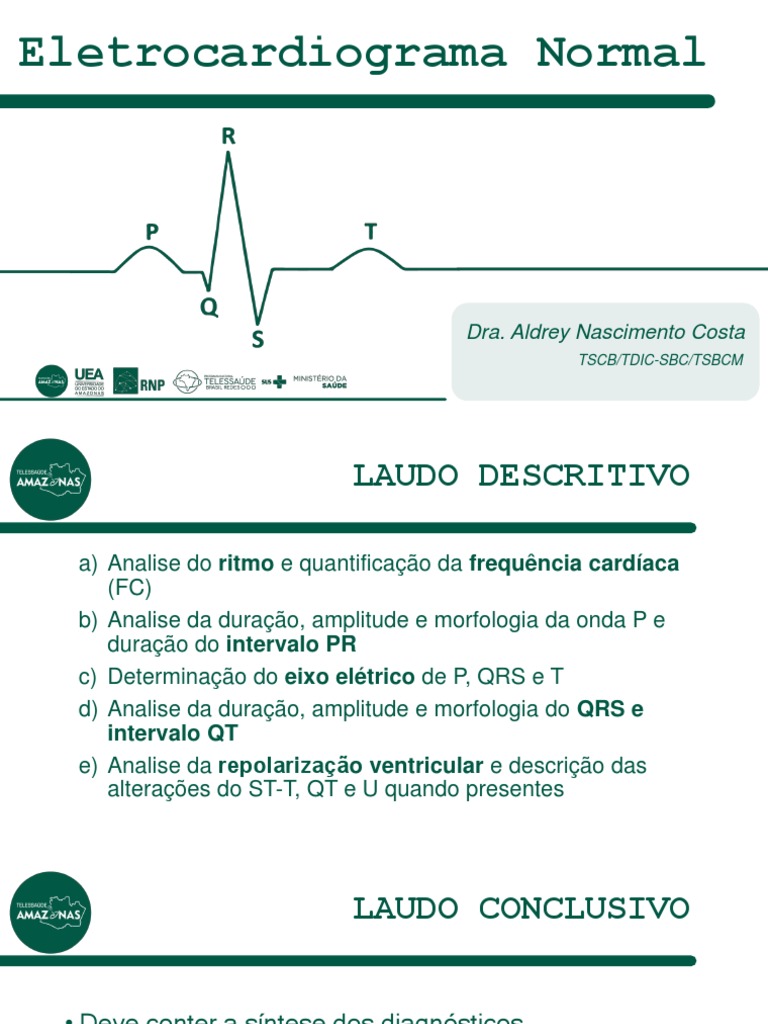 Eletrocardiograma Normal | PDF | Eletrocardiografia | Sistema circulatório