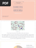 esferocitose hereditária