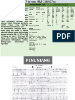 Nefritis Lupus