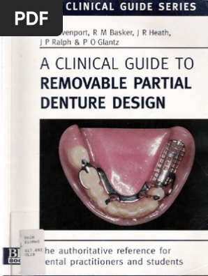 A Clinical Guide To Removable Partial Denture Design Pdf Dentures Dentist