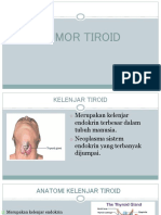 PENGOBATAN TUMOR TIROID