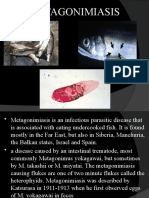 METAGONIMIASIS