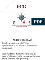 ECG Detailed