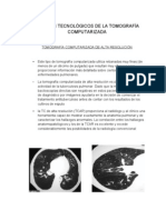 Avances Tecnológicos de La Tomografía