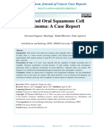Advanced Oral Squamous Cell Carcinoma: A Case Report: American Journal of Cancer Case Reports