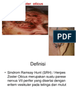 Herpes Zoster Oticus