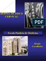 Sérgio Hérnia de Disco Cervical