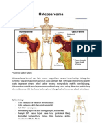 OSTEOSARKOMA - Arnest