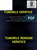 Tumori Hepatice