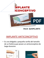 Implante Anticonceptivo