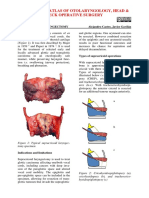 Open Access Atlas of Otolaryngology, Head & Neck Operative Surgery
