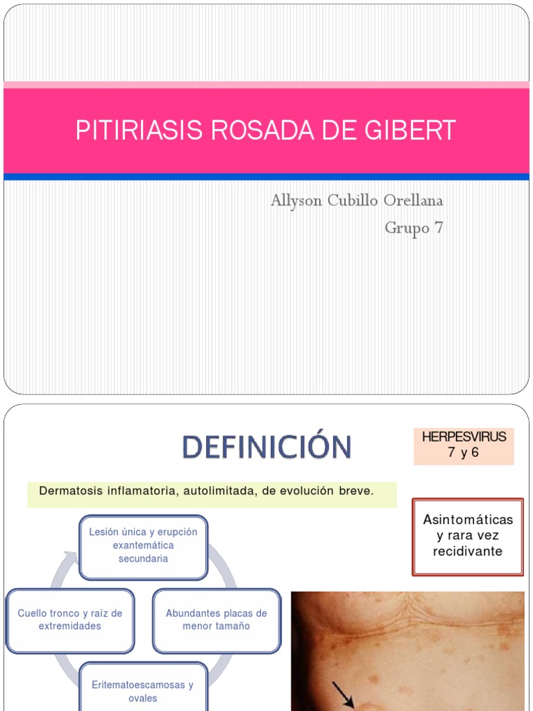 pitiriasis-rosada-de-gibert-pdf-especialidades-medicas-medicina