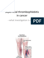 Superficial Thrombophlebitis in Cancer