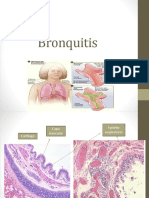 Bronquitis