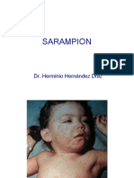 Sarampion.pdf