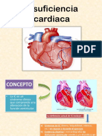 insuficiencia cardiaca