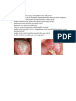 Oral Lichen Planus Dan Leukoedema