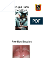 Cirugía Bucal Pediátrica