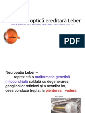 Nevrita optică sau inflamația nervului optic: simptome și tratament