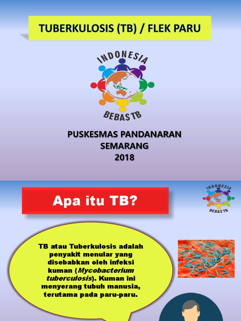 Tb Presentation