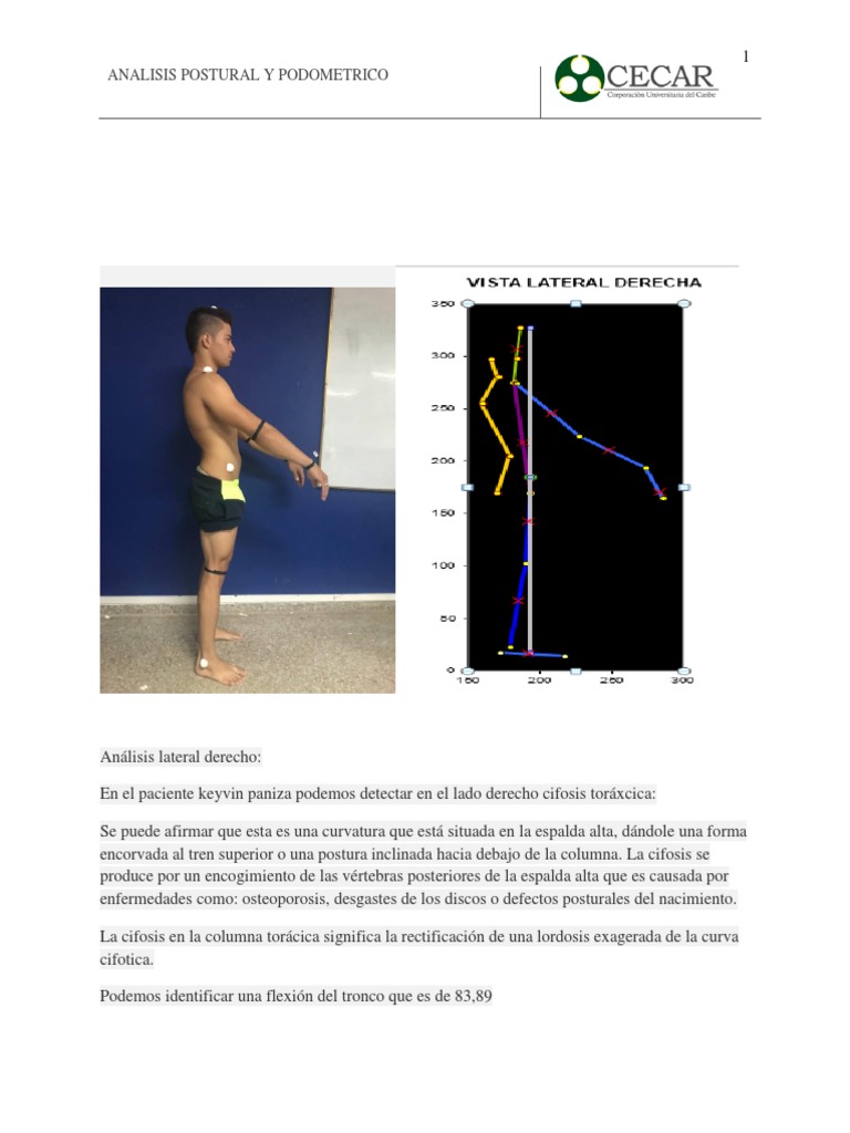 Analisis Podometrico y Postural Keyvin | PDF | La columna vertebral ...