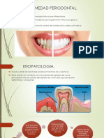 EnfermedadPeriodontalCausasTratamiento