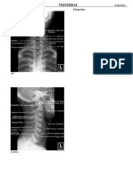 Radiologi Vertebrae