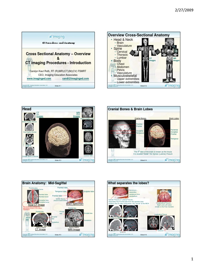 CT Anatomy \u0026 Procedures Guide | PDF | Human Brain | Corpus Callosum, image size:768x1024
