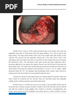Download A Case Study on Rectal Adenocarcinoma by Jai - Ho SN38688220 doc pdf