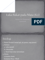 K2-J-Luka Bakar Pada Mata