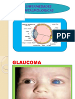 Enfermedades de Oftalmologicas