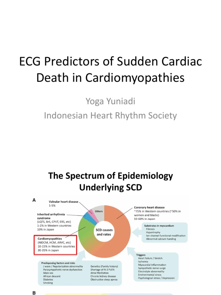 ECG Predictors of Sudden Cardiac Death in Cardiomyopathies: Yoga ...