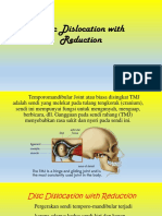Disc Dislocation With Reduction 
