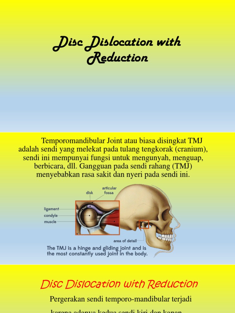 Disc Dislocation With Reduction | PDF
