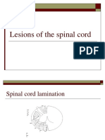 kuliah Lesions of the Spinal Cord