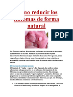 Cómo Reducir Los Fibromas de Forma Natural