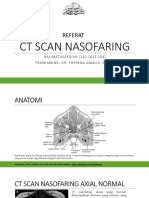 CT Scan Nasofaring