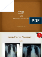 CXR 2