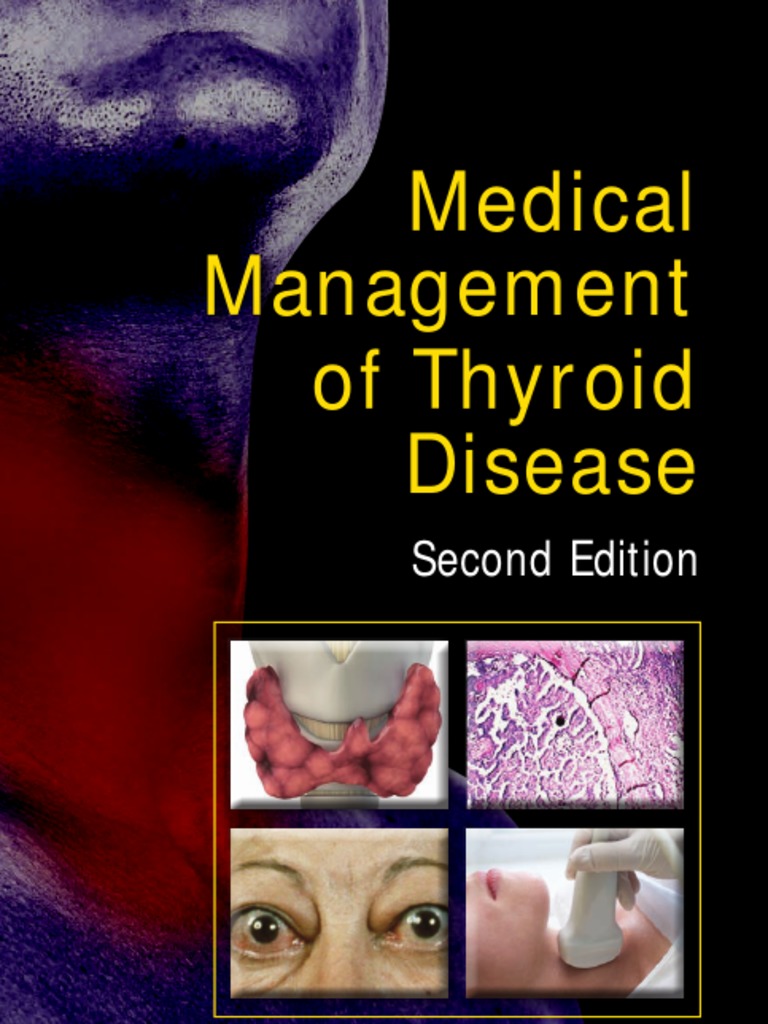 Medical Management Of Thyroid Disease Pdf Thyroid Stimulating Hormone Hyperthyroidism