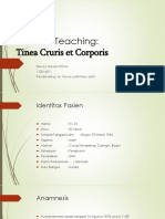 Bed Site Teaching:: Tinea Cruris Et Corporis