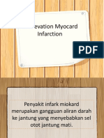 ST Elevation Myocard Infarction